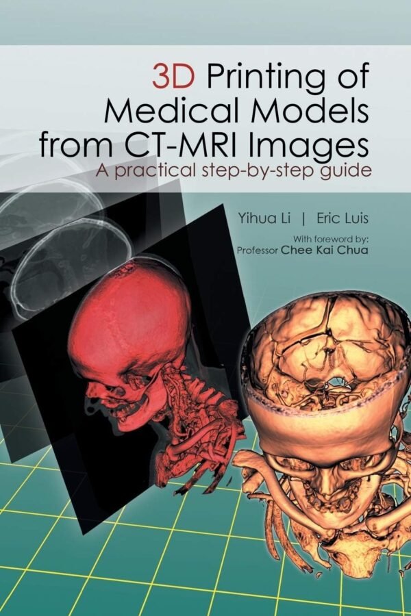 3D Printing of Medical Models from CT MRI Images