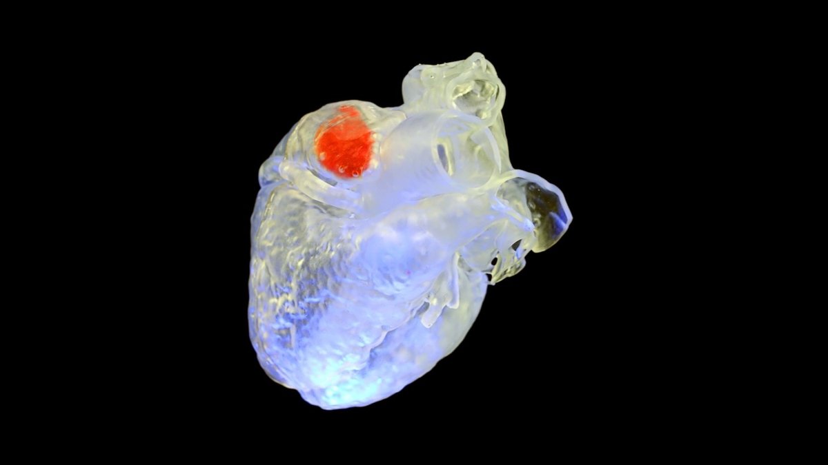 Revolutionizing Medicine: Ultrasonic 3D Printer for Non-Invasive Organ Repair